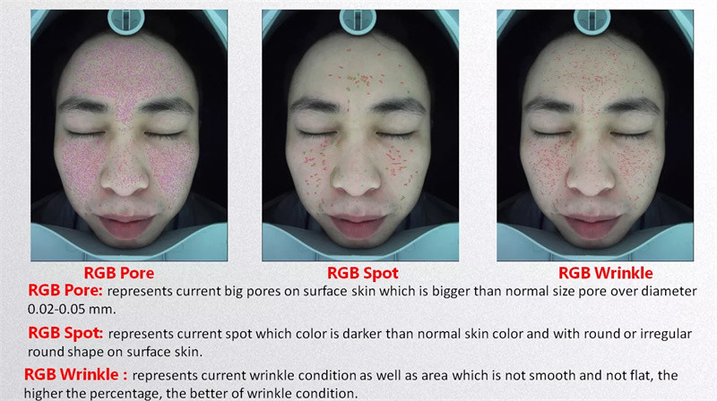 Portable Ai 20 Million Facial Scanner Skin Analyzer 3d Uv Magic Mirror