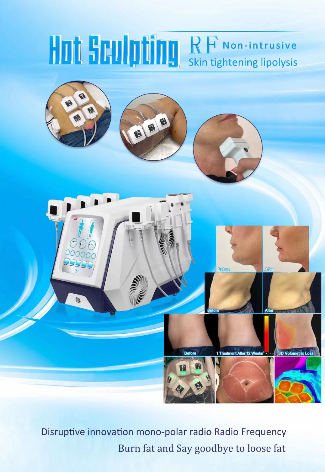 10 Handles Trusculpt ID Machine Portable Radio Frequency Fat Reduction Machine 2MHz