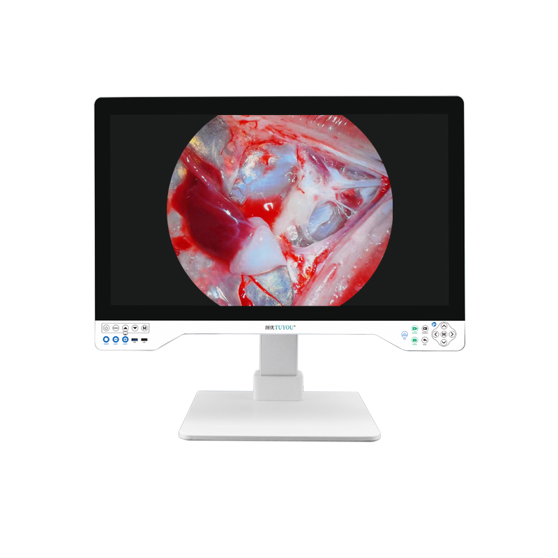 TUYOU 15.6'' UHD All In One Rigid Multi Flexible Endoscopy Camera System For Endoscopy Of Uterus