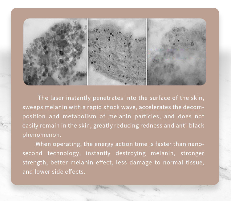 Q Switch Picosecond Laser Tattoo Removal Machine 1320nm For Clinic