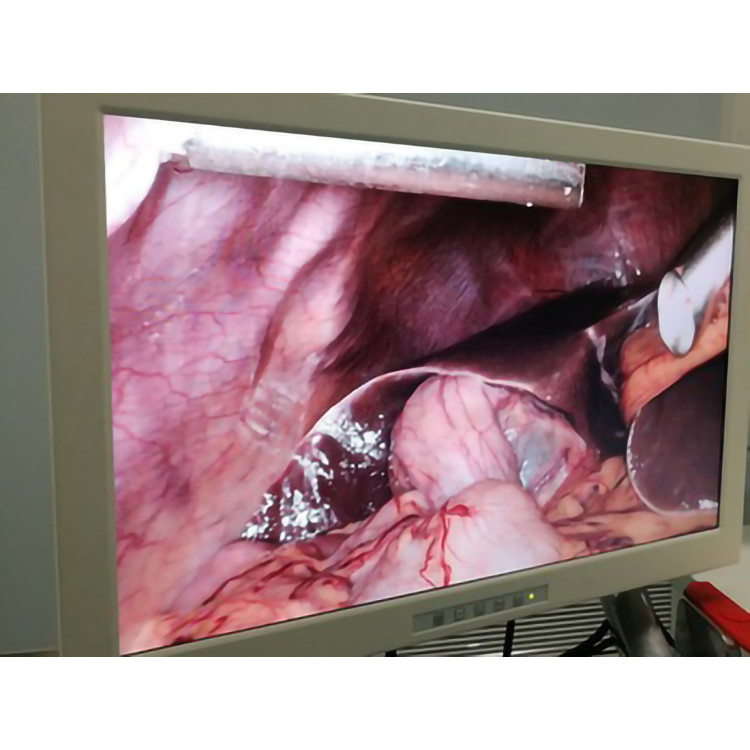 OEM Laparoscopic Camera System 15 Inch Full Hd Endoscope Camera With Coupler