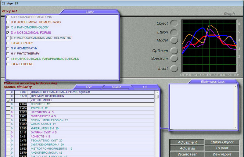 Quantum Resonance 3d Nls Health Analyzer For Full Body Diagnostic