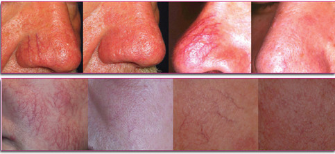http://yi.everychina.com/photo/ipllaser-beauty-machines/editor/20140116100421_35527.jpg
