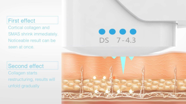 2016 Amazing USA High Intensity Focused Ultrasound face lifting hifu/hifu face lifting