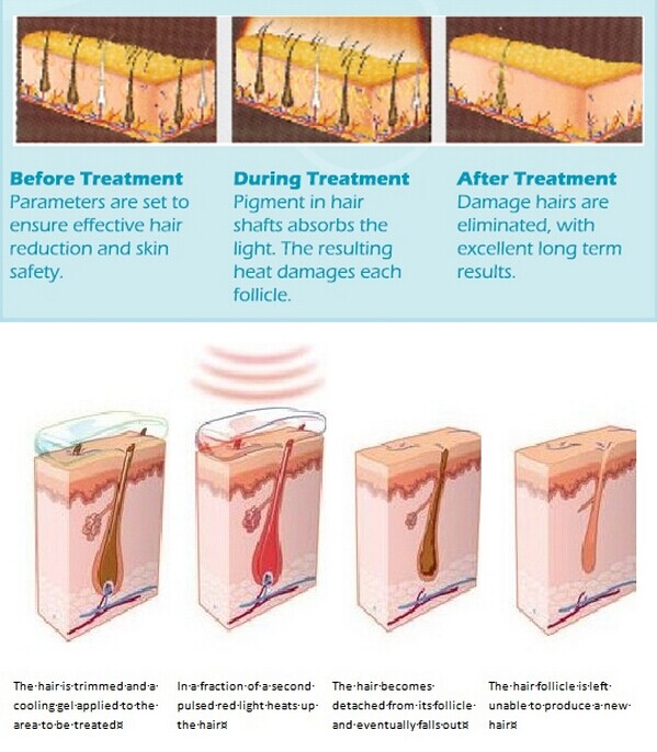 2019 new launched hair removal machine 3 handles ipl professional machine with USA connector