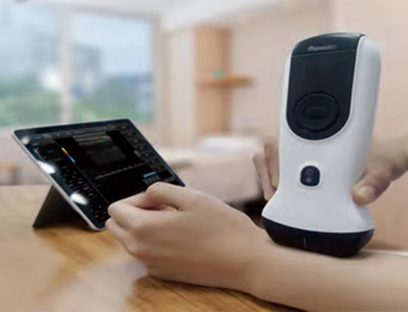 LUSONIC Portable Ultrasound Device for B/C Mode and Spectral Doppler Aesthetic Medicine Equipment with Full HD Resolution