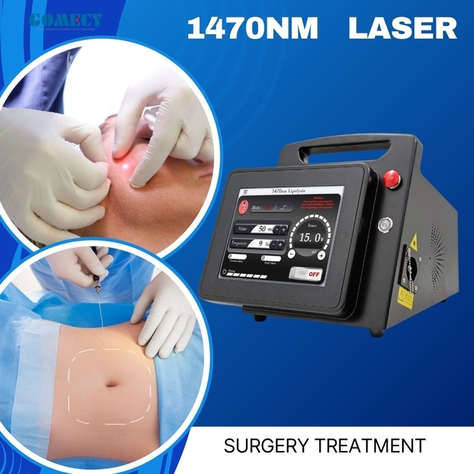 GOMECY 1470nm 980nm/30W Fat Reduction Endolift Laser Device Endolaser Fat Cellulite Reducer Machine