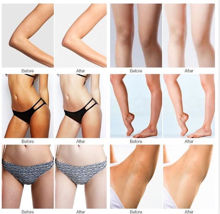 beauty armpit whitening cream for dark underarms