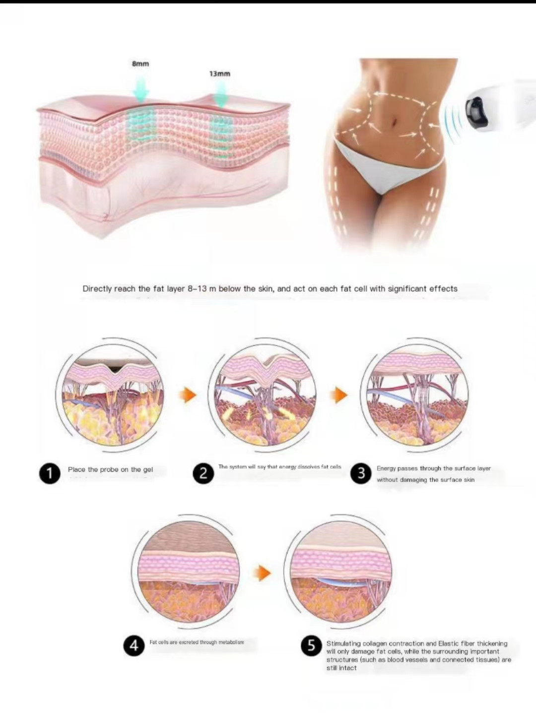 Liposonic Ultrasound HIFU Beauty Machine 0.8cm 1.3cm Cellulite Reduction