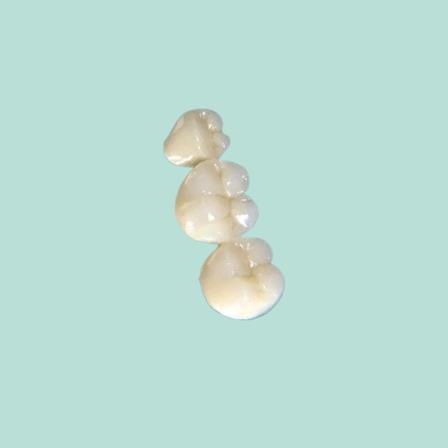 Hard Texture Dental Crowns And Bridges Exercising Chewing Function Comfortable