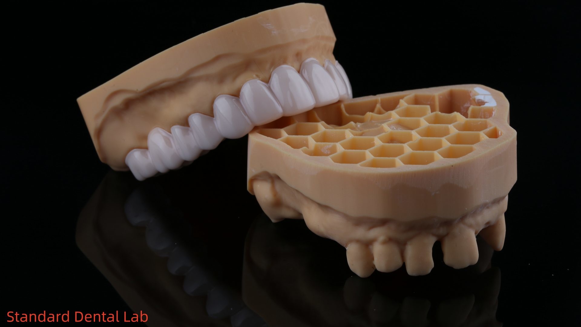 High Esthetics Dental Snap On Smile Standard Dental Lab Removable Dental Appliance