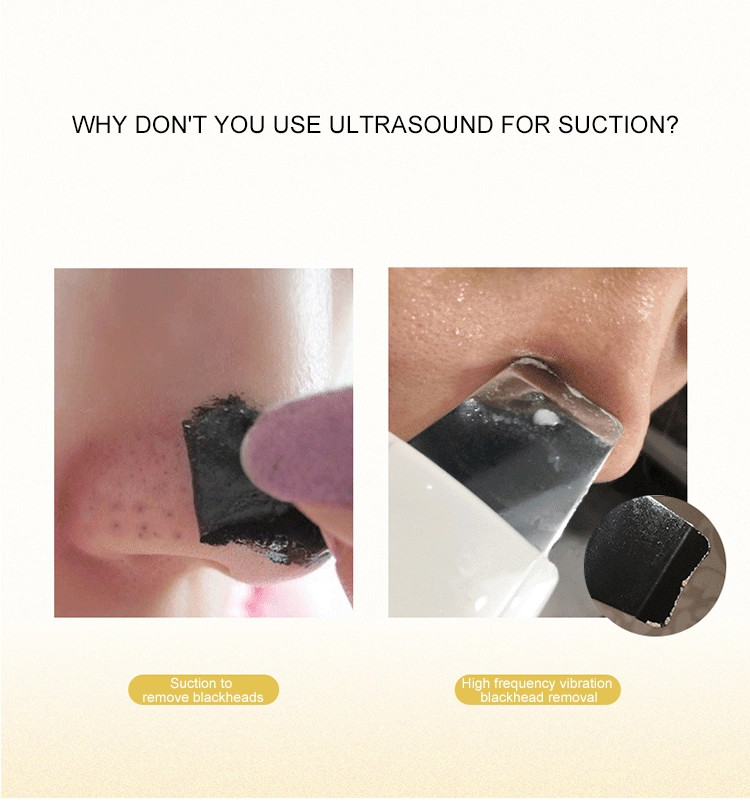 FCC Skin Whitening Rejuvenation Ultrasonic Skin Scrubber