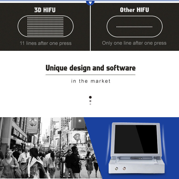 Portable Hifu 3D Face and Body Lifting Machine Advanced for Beauty Spa