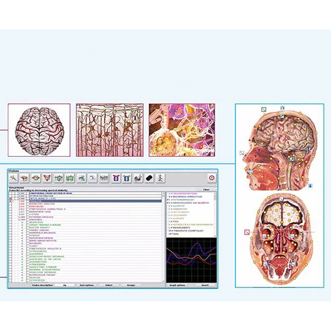 Clinical Metatron NLS FREE Shipping SSCH 4025 Bioresonance Health Scan And Therapy Equipment