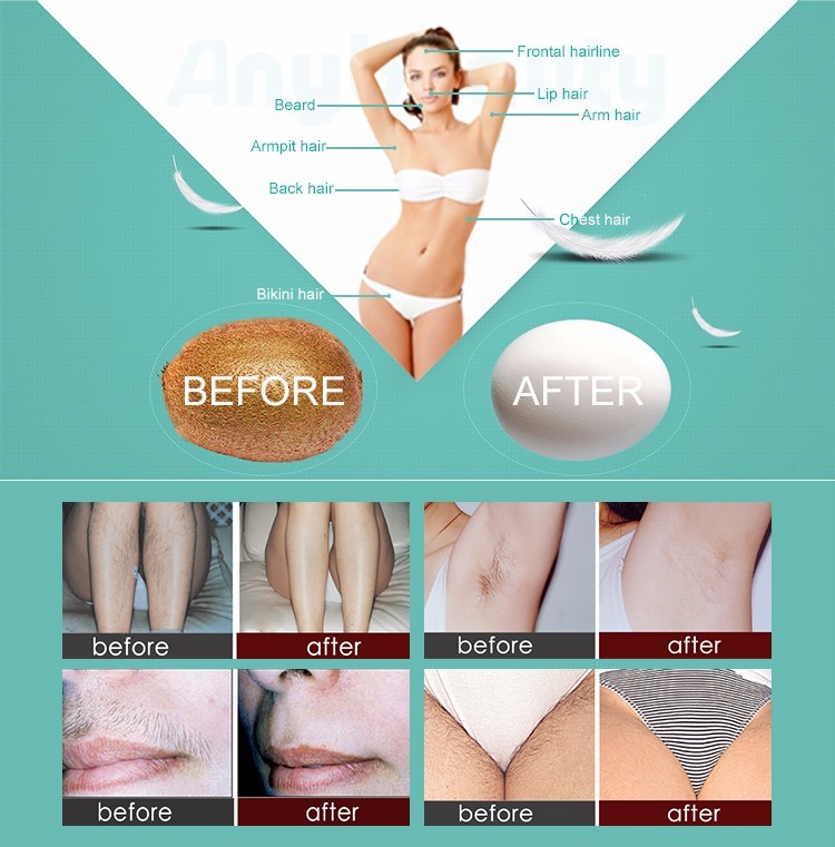 Home Use Portable Ipl Hair Removal Painless Laser Hair Removal