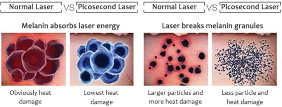 Q - Switch Picosecond Laser Tattoo Removal 2 - 10mm Spot Diameter For Beauty SPA 4