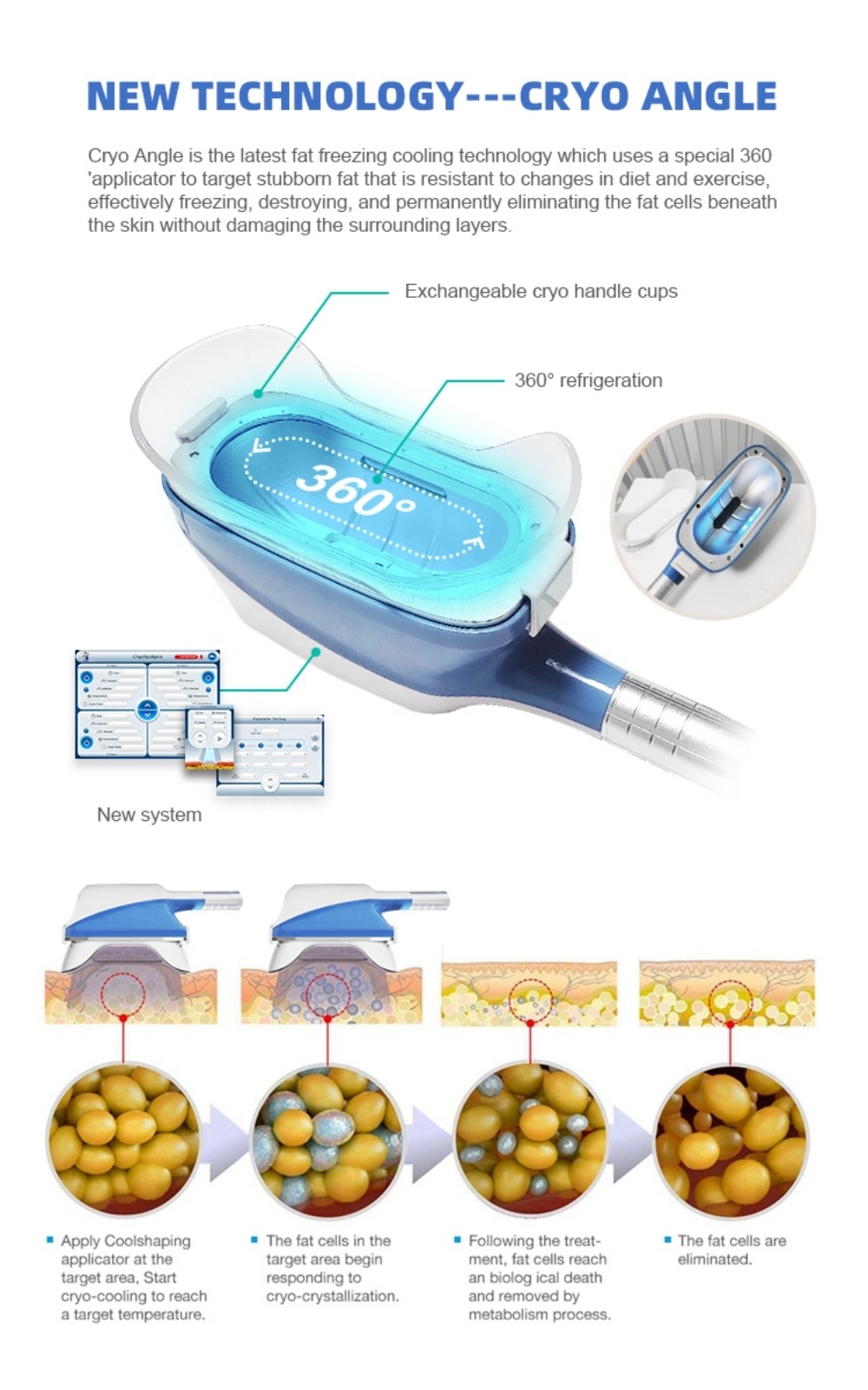 Skin Tightening Cryolipolysis Slimming Machine RF Vacuum 360 Fat Freezing Device
