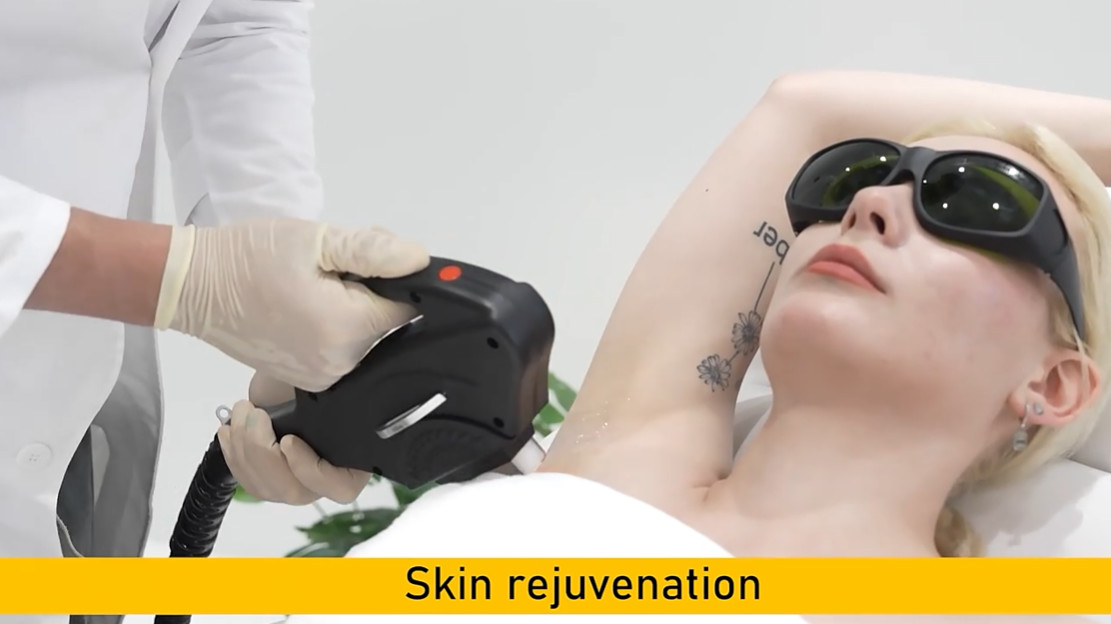 Multifunctional IPL RF DIODE LASER ND YAG LASER tattoo removal and hair removal skin rejuvenation salon use