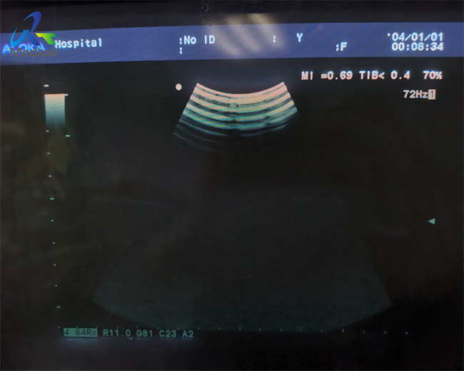 Aloka ASU-1010 Ultrasound 4D Probe Repair Motor Control Failures