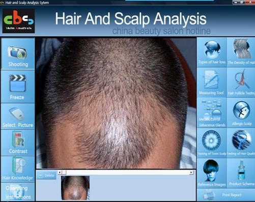 Salon Beauty Wholesalers Skin and Hair Analyzer Machine