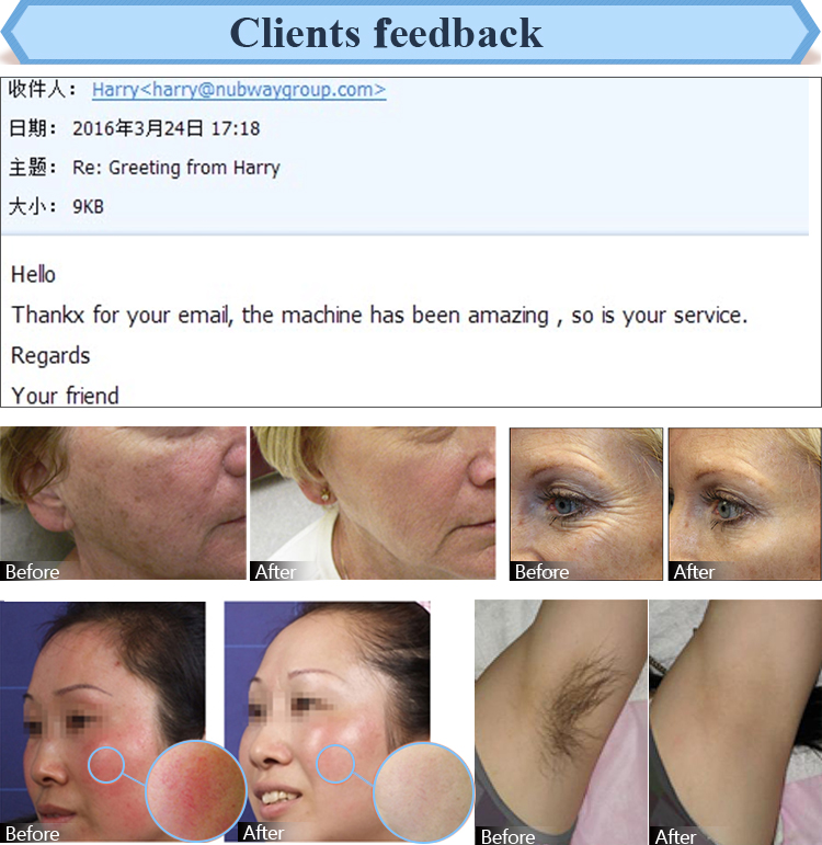 Beauty Salon / Clinic Use SHR IPL Hair Removal / Princess SHR For Hair Removal