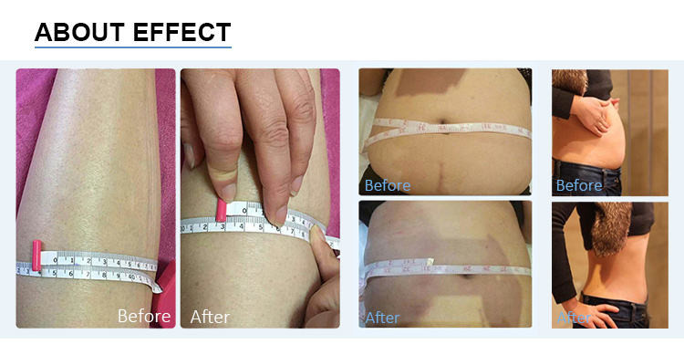 Weight Loss Vacuum Cavitation Machine RF 80K Cellulite Removal Beauty Device