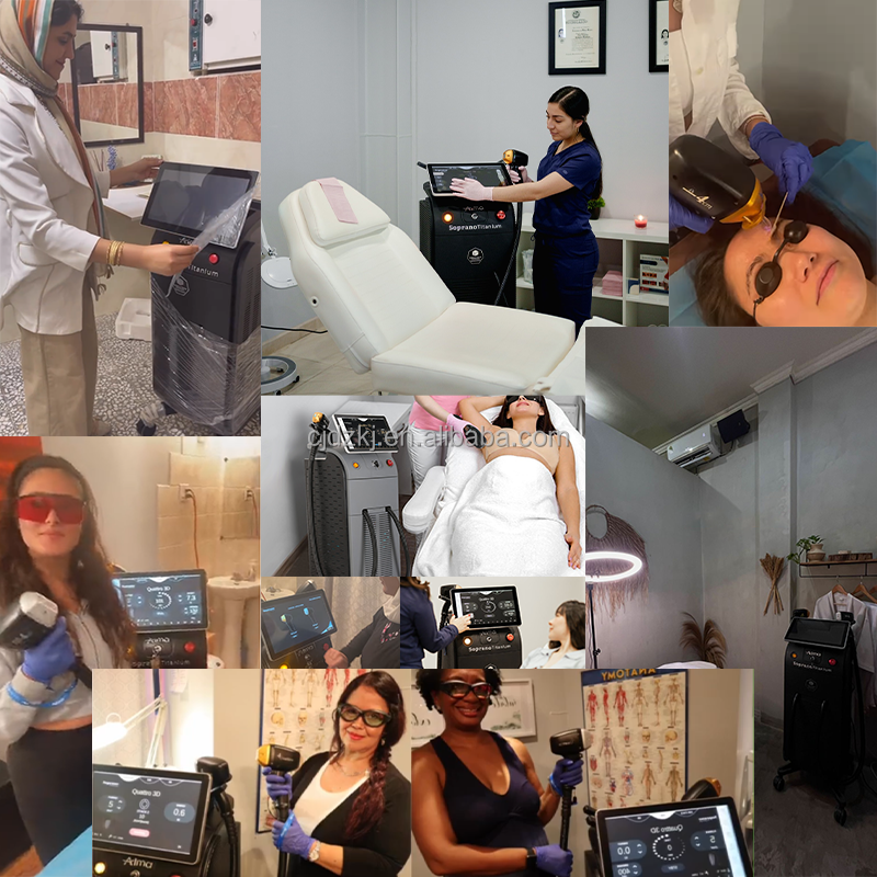 808 Diode Laser Hair Removal Machine 755nm 808nm 1064nm Diode Laser Equipment Triple Waves