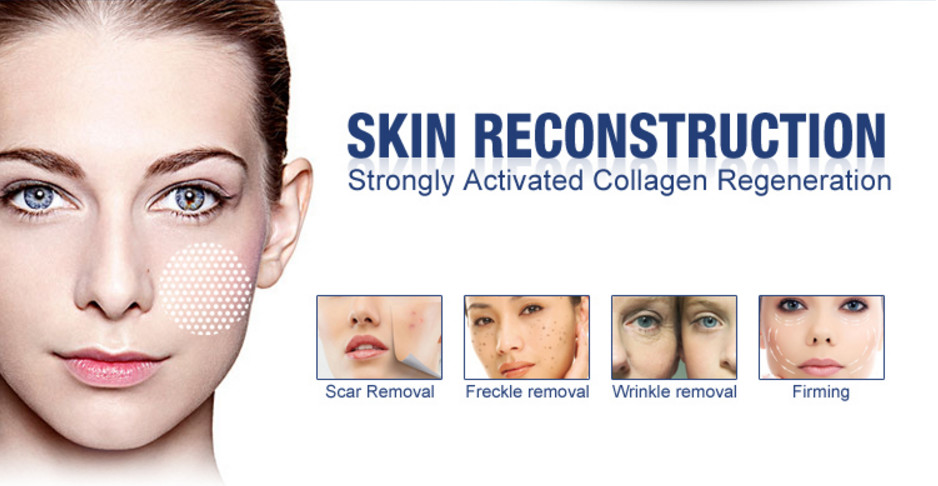 Micro CO2 Fractional Laser Machine , Fractional Carbon Dioxide Laser Resurfacing Equipment