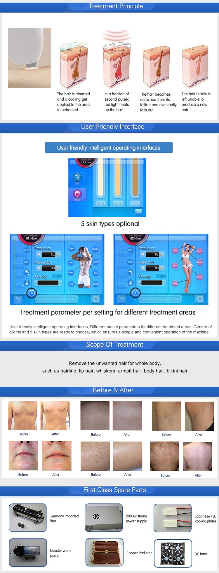 Permanent diode laser hair removal machine for Spa or Salon use