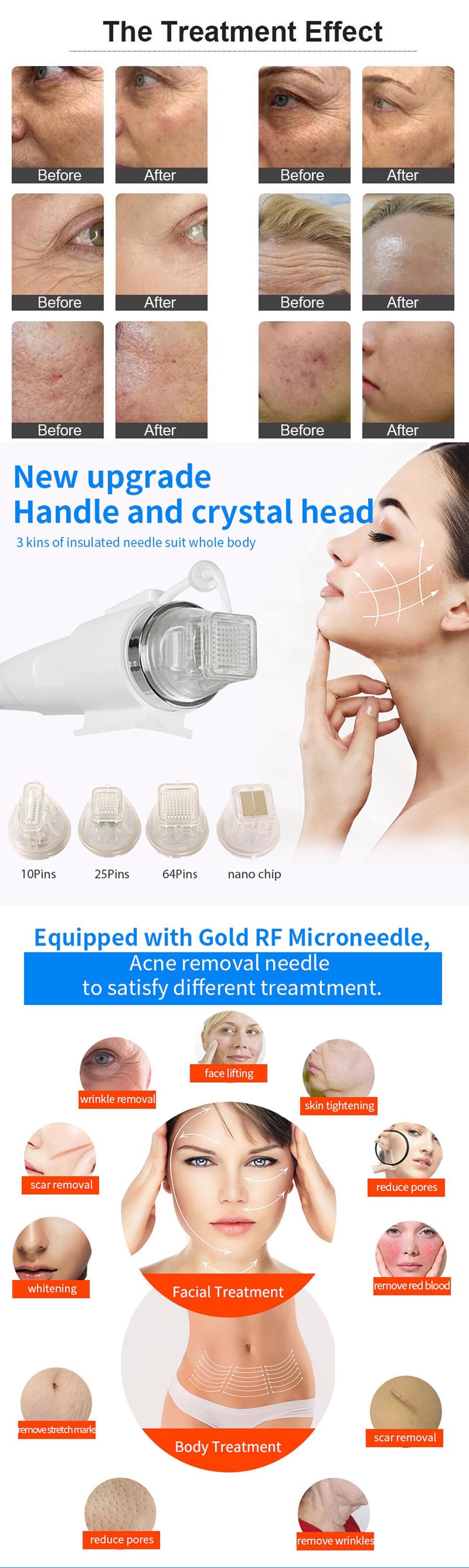 Gold Mic-Needle Beauty Device Acne WrinkleTreatment Wrinkle Removal Skin Rejuvenation Treat Beauty-Machine