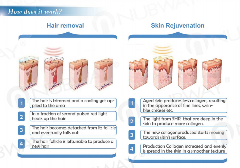 Ipl hair removal soprano diode laser skin hair removal ipl machine ipl light