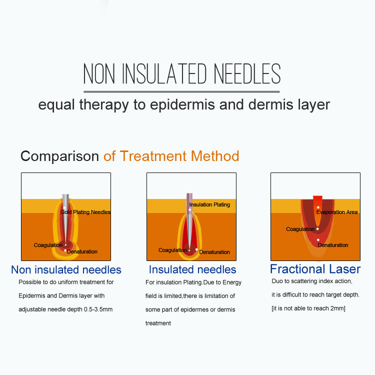 4 Tips 2MHz Fractional Rf Skin Tightening Machine