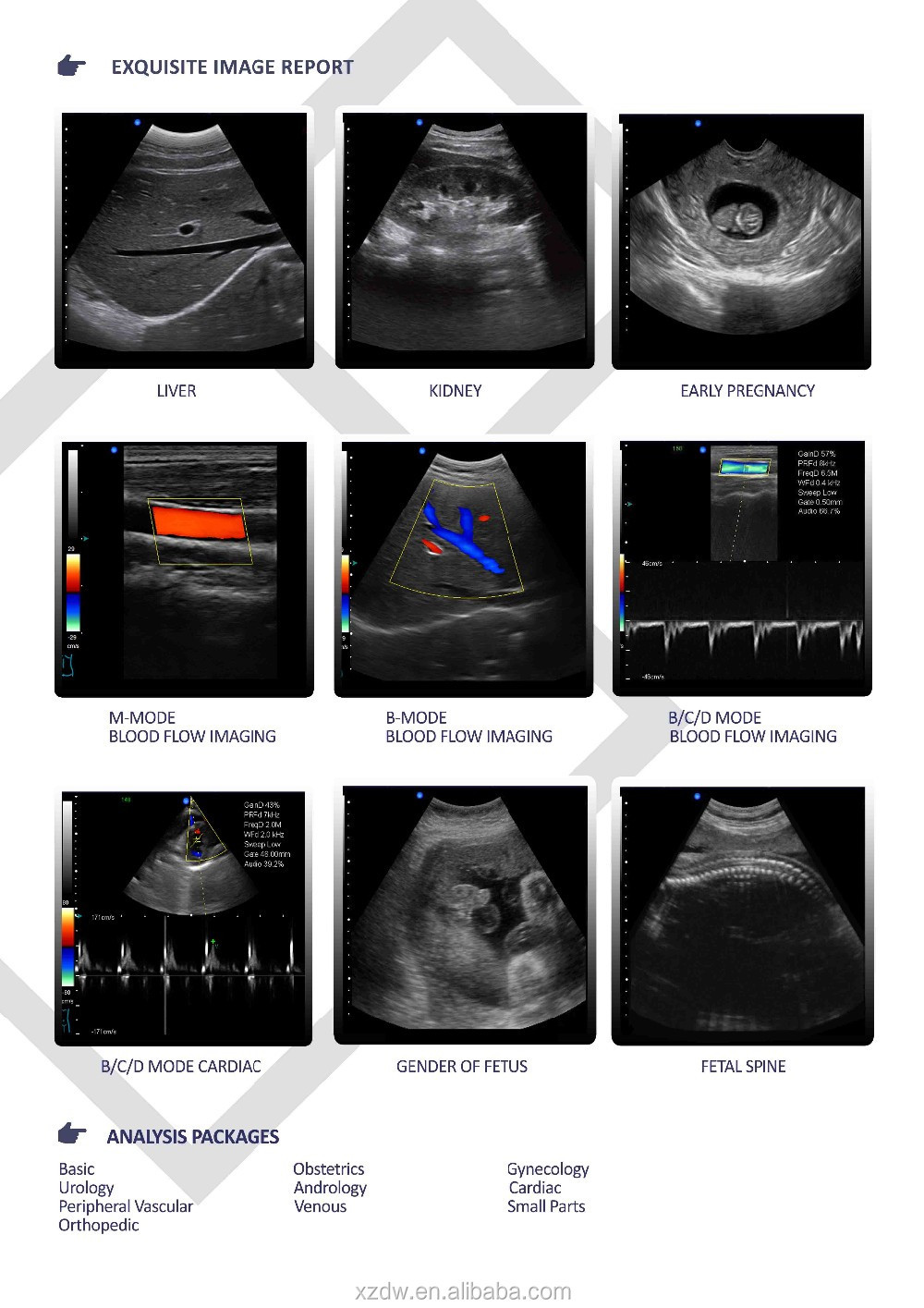 GH-L5 Portable Ultrasound Machine 4d Diagnostic Ultrasound Pregnancy Machine