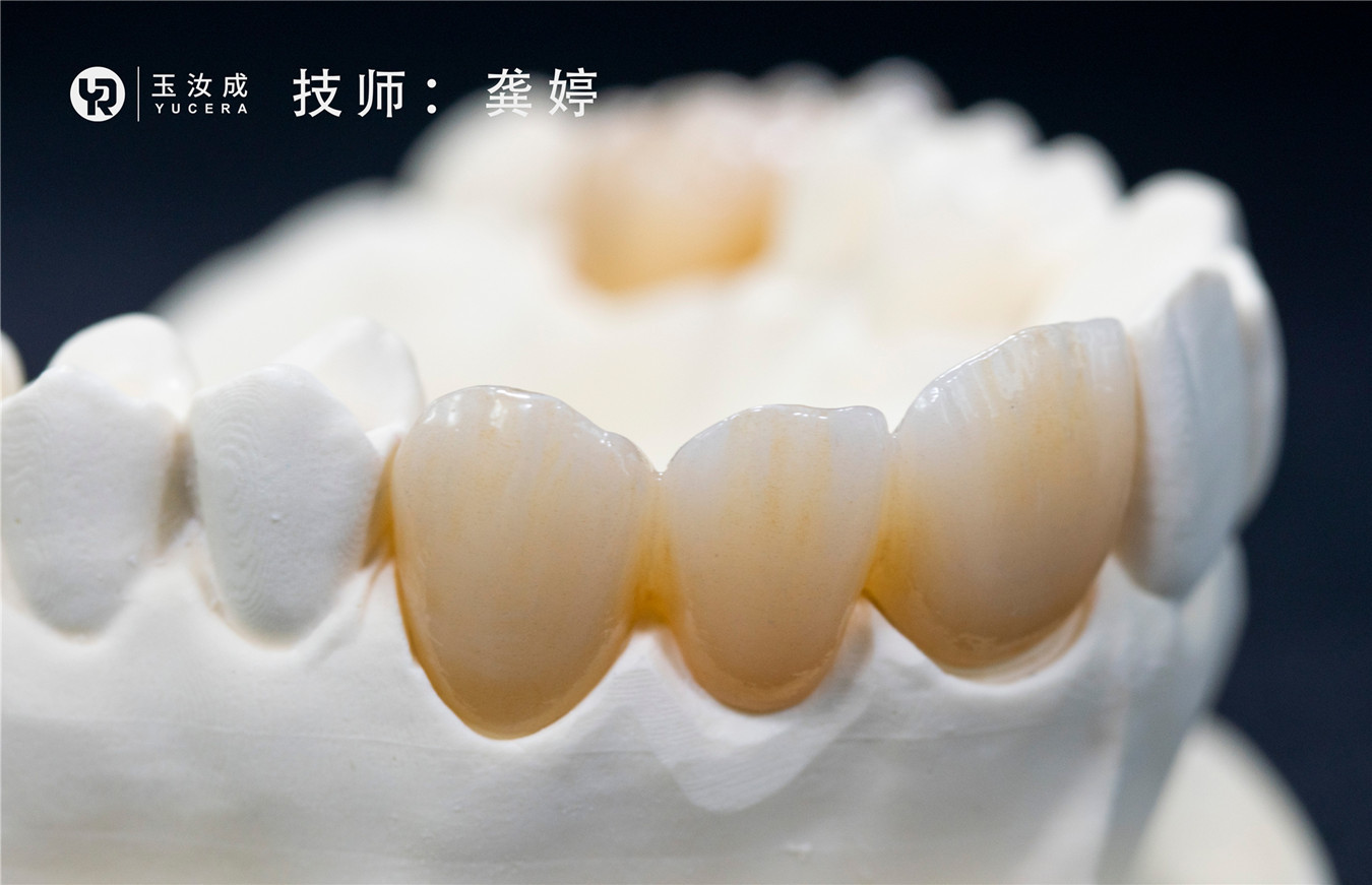 Aesthetics Multilayer Zirconia Disc Self Colored 3D Pro CFDA For 1500℃