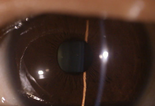 3 Lens Available Ophthalmic Equipment Digital Fundus Camera Eye Surface Camera Eye Anterior Lens Replaceable