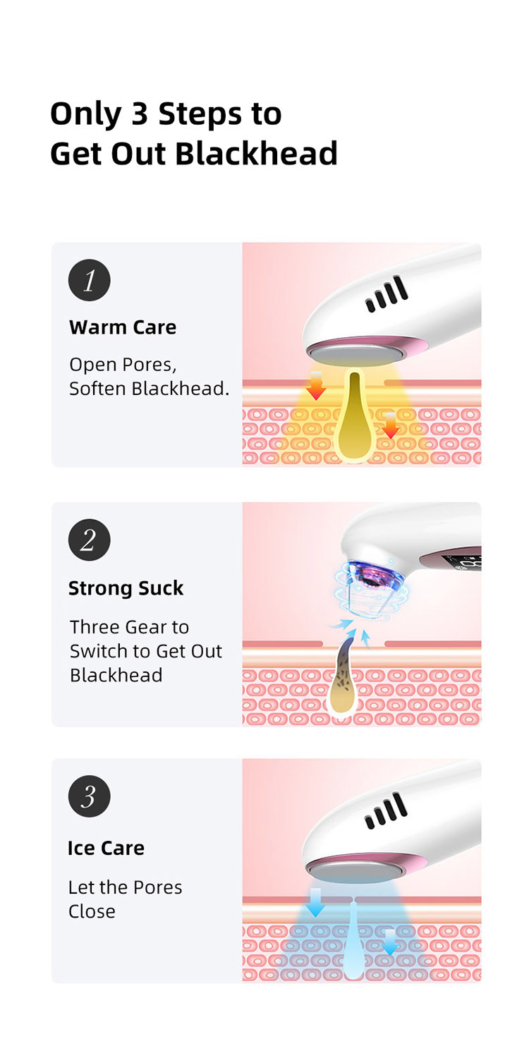 Hot Ice Switch 8.8W Acne Remover 60kPa Vacuum Suction Beauty Device