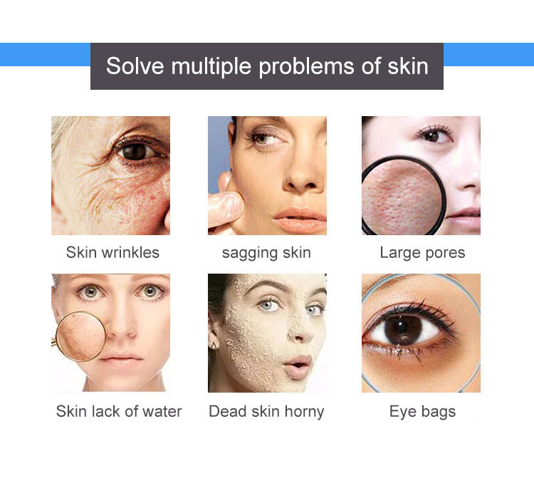 9 In 1 Comprehensive Management Skin Beauty Machine For Deep Cleaning