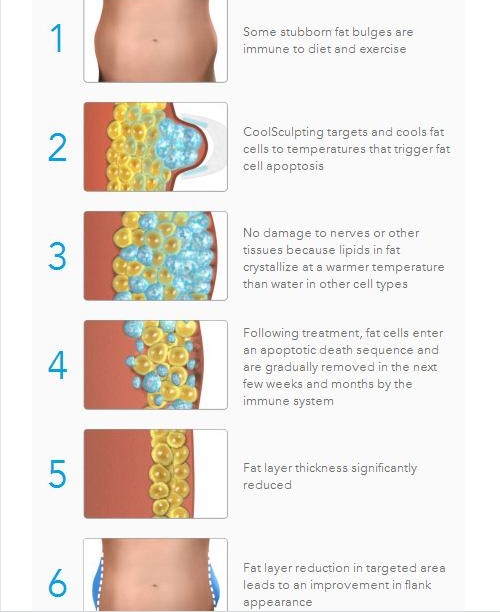 Multi-Functional beauty equipment kryolipolyse cool tech slimming machine cryolipolysis fat freezing equipment