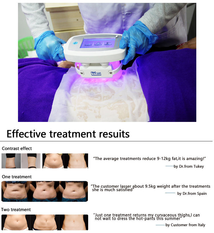 6 Handles 40khz Ultrasonic Cavitation RF Cryolipolysis Slimming Machine