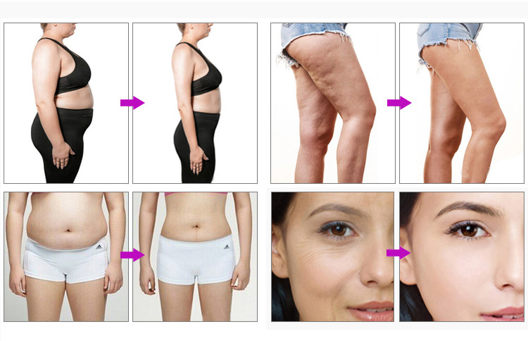 7 In 1 Vacuum Cavitation Machine Body Slimming RF Laser Beauty Instrument