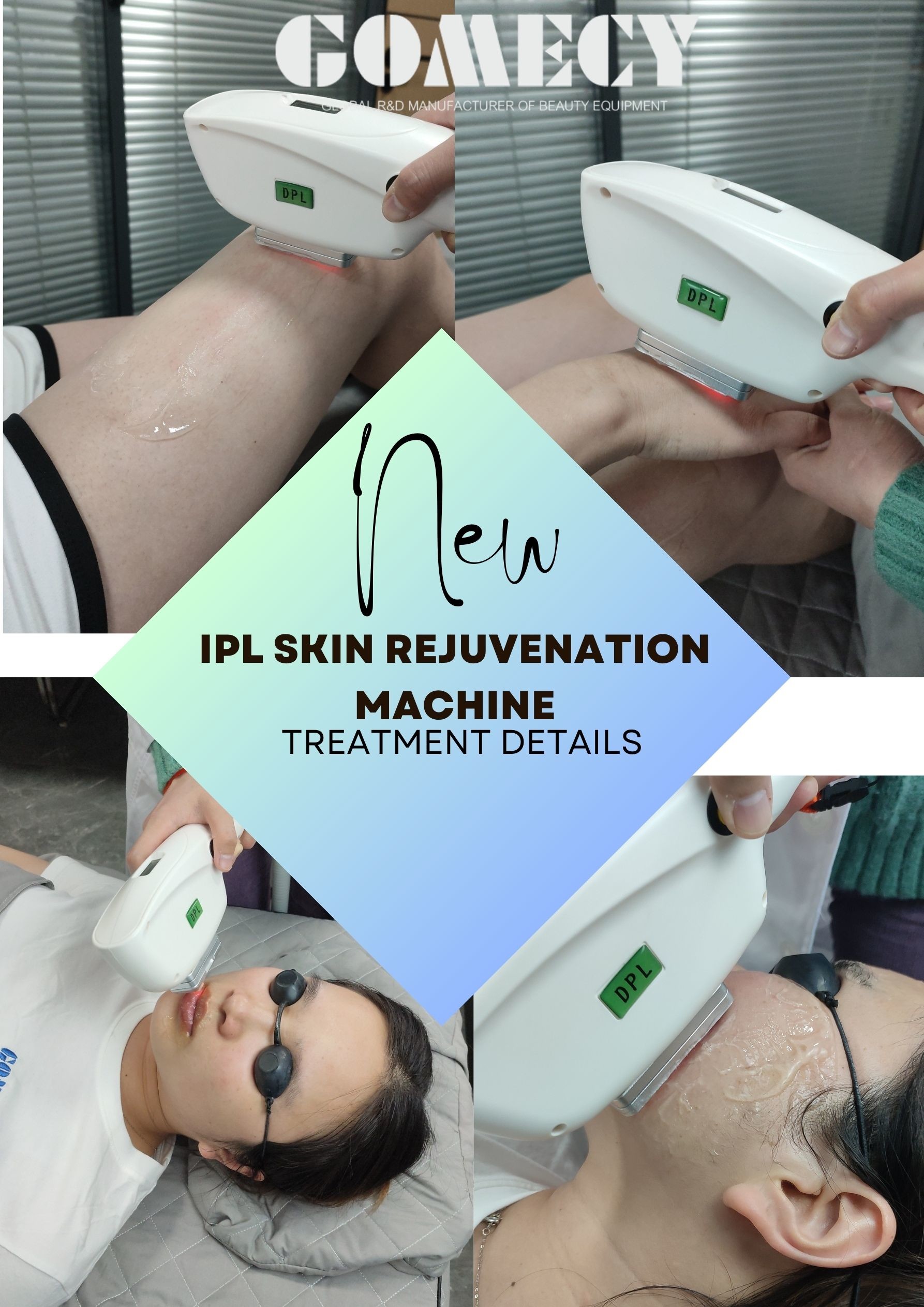 1000W Ipl Shr Laser Machine For Freckle And Vascular Lesions Removal