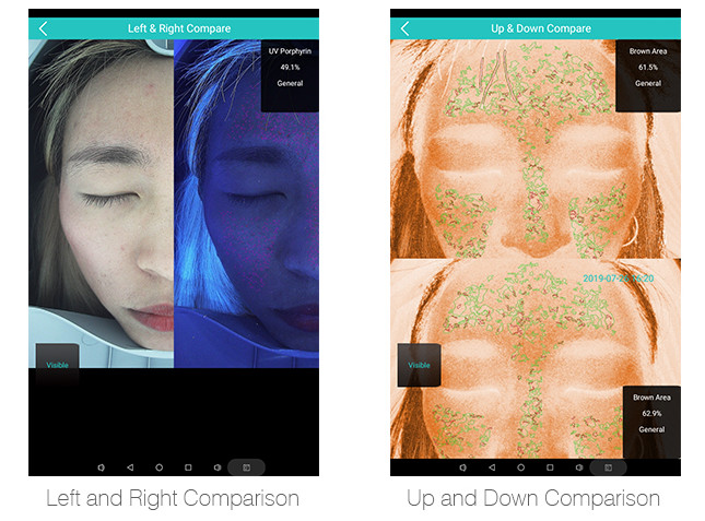 Portable Skin Analyzer Machine , Beauty Skin Testing Analysis Machine
