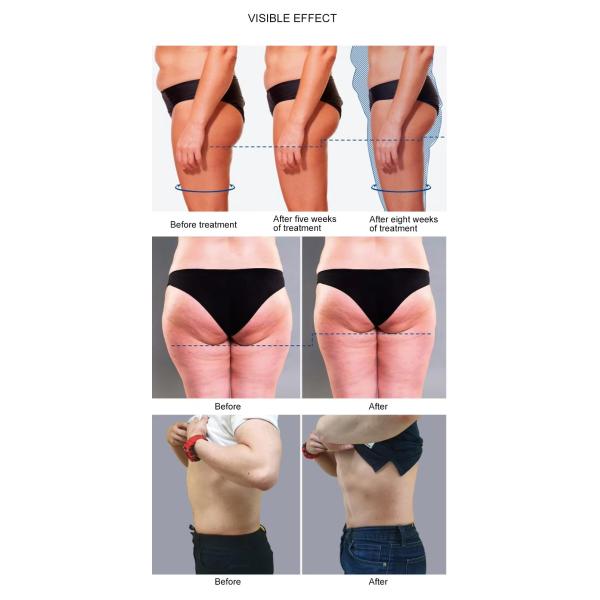 Portable EMS Slimming Muscle Stimulator