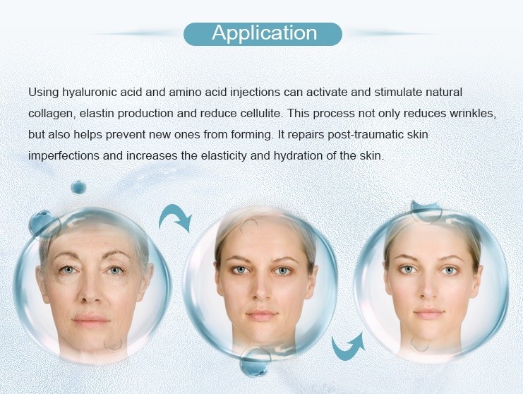 Mesotherapy Injection 9 Pins Needle For Microneedling Treatment