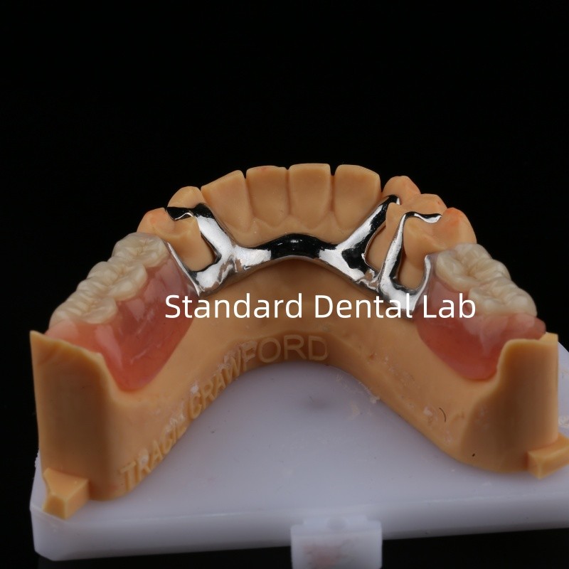 Alloy Metal Partial Denture Framework 3 Shape Exocad Laser Printing Lower Cast Partial Finish