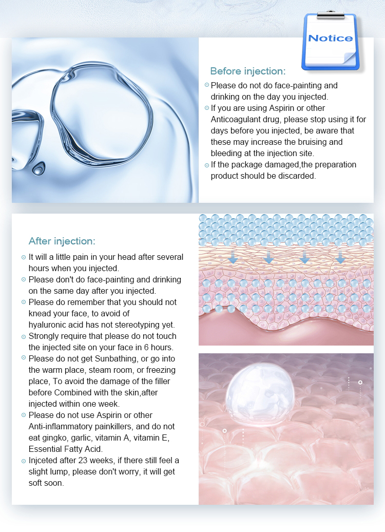 Breast Enlargement Cross Linked Ha Filler , Hyaluronic Acid Gel Filler