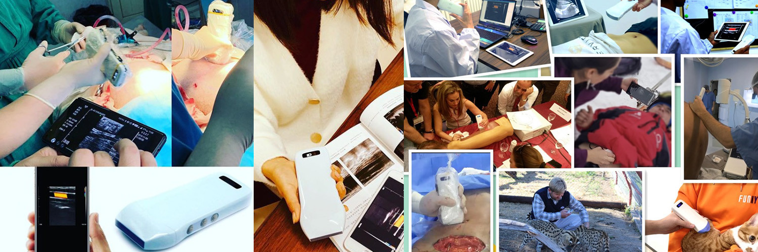 128 Elements Medical Hospital Equipments Color Doppler Portable Wireless Ultrasound Machine 3 In 1