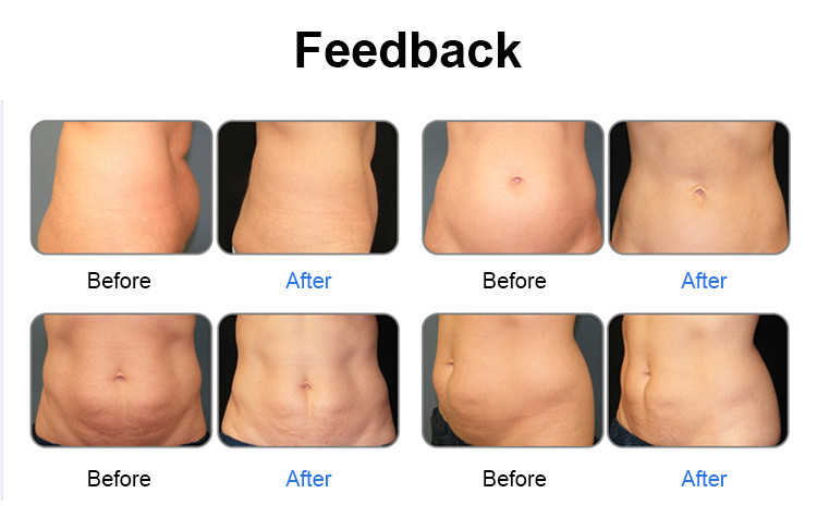 Air Cooled 300W Fat Melting Device Non invasive 6D Laser Slimming Machine For Lifts Buttocks
