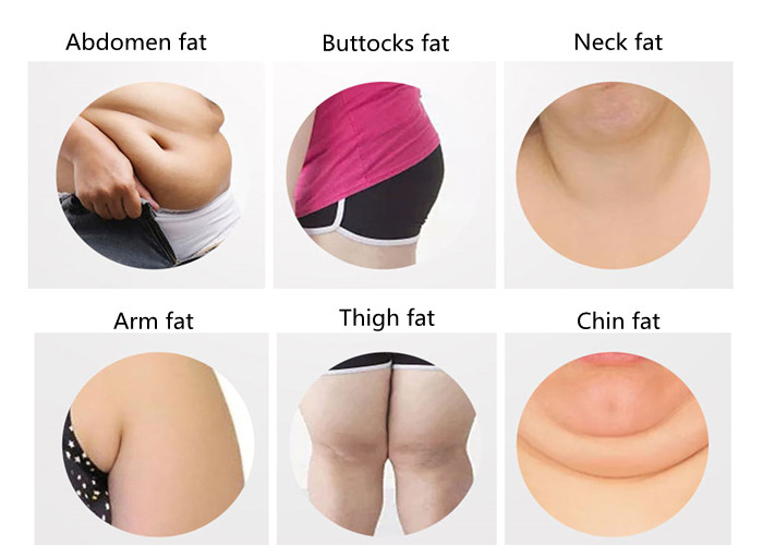 Ce Approved Body 40Khz Cryolipolysis Slimming Machine 360 Vacuum Weight Loss