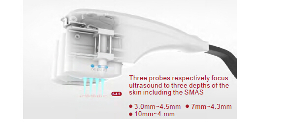 Most effective HIFU face lifting machine for beauty clinic use